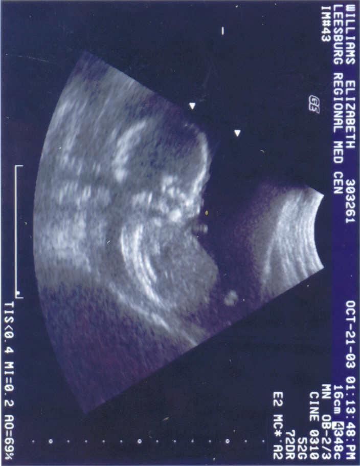 ultrasound2.jpg